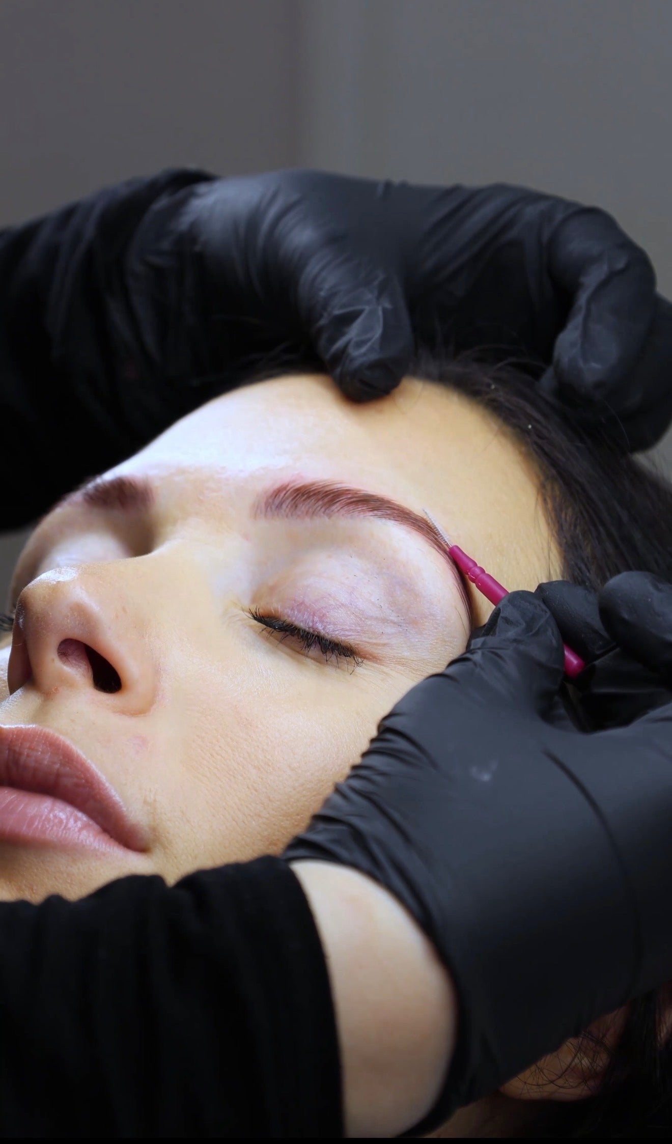 Formation Brow lift °Vidéos HD + PDF