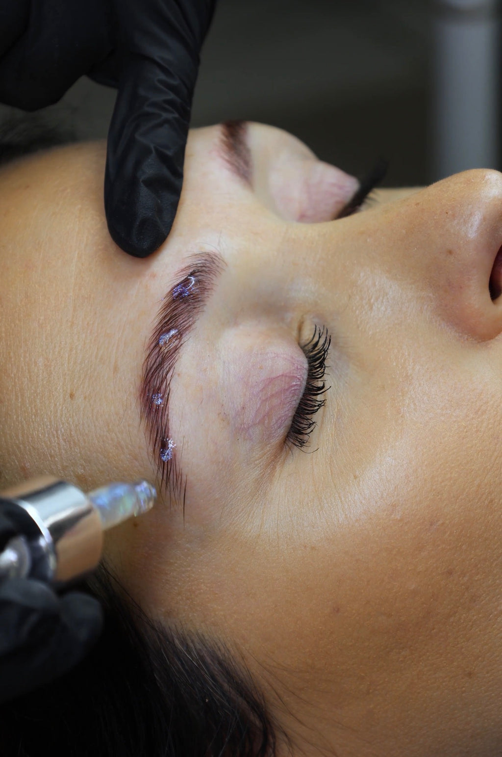 Formation Brow lift °Vidéos HD + PDF